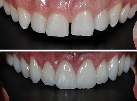 Harmonizacao Orofacial